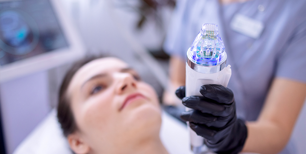 Tips para Microneedling